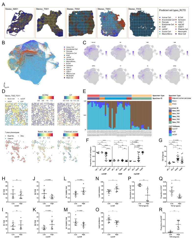 图2. Stereo-seq 揭示肿瘤内 CAF 的异质性